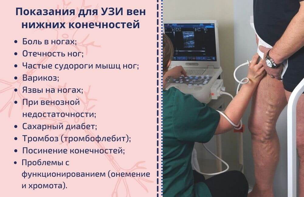 Показания к УЗИ вен нижних конечностей Показания к УЗИ вен нижних конечностей