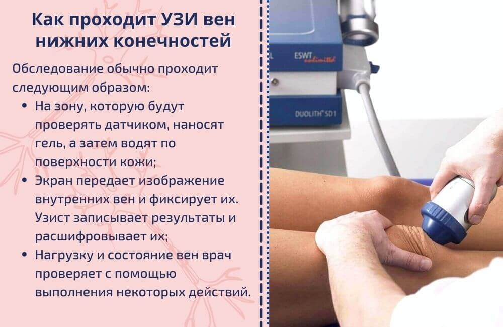 Этапы проведения УЗИ нижних конечностей Этапы проведения УЗИ нижних конечностей